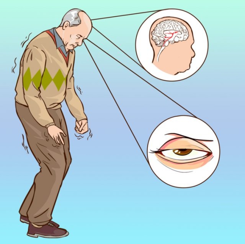 10 causes of sudden visual impairment