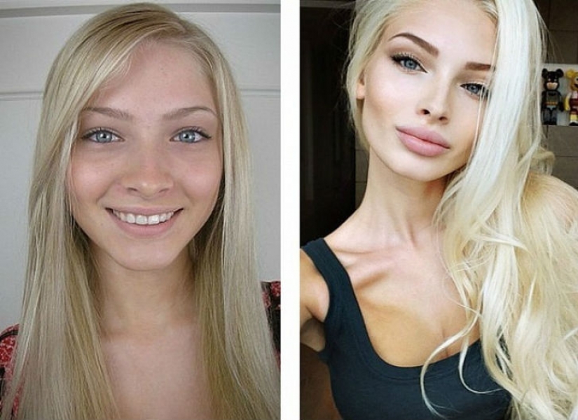 10 Russian beauties before and after plastic surgery