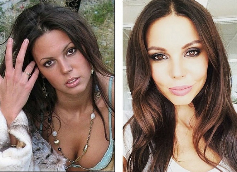 10 Russian beauties before and after plastic surgery