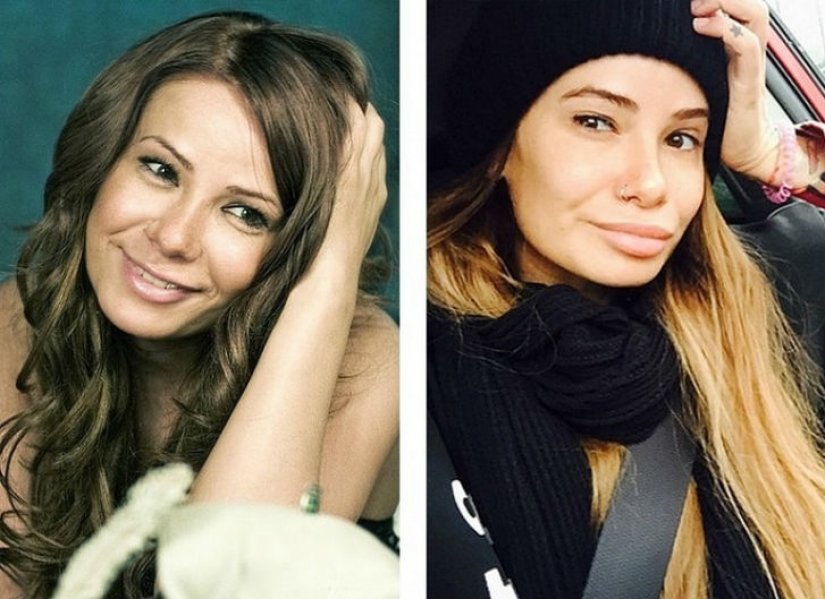 10 Russian beauties before and after plastic surgery