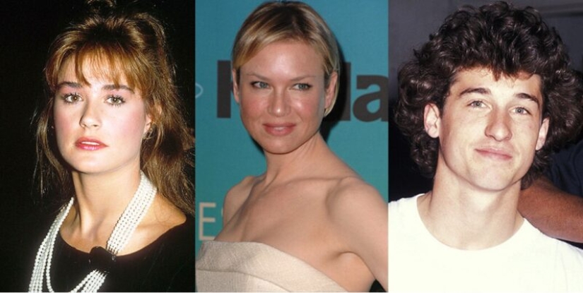 10 stars who have had chin plastic surgery