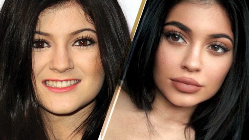 15 celebrities who has changed most over the last decade