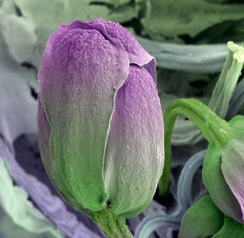 15 fascinantes fotos de productos bajo el microscopio