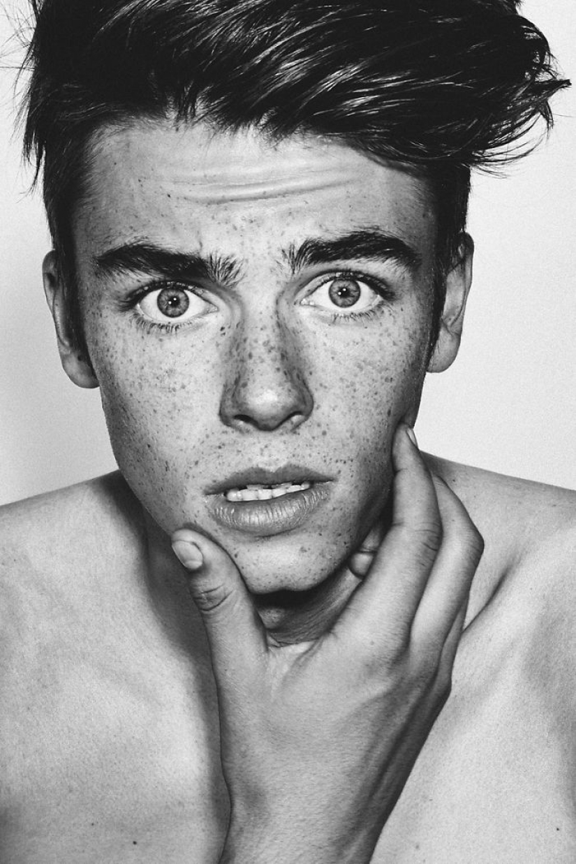 16 fascinating photos of people with freckles