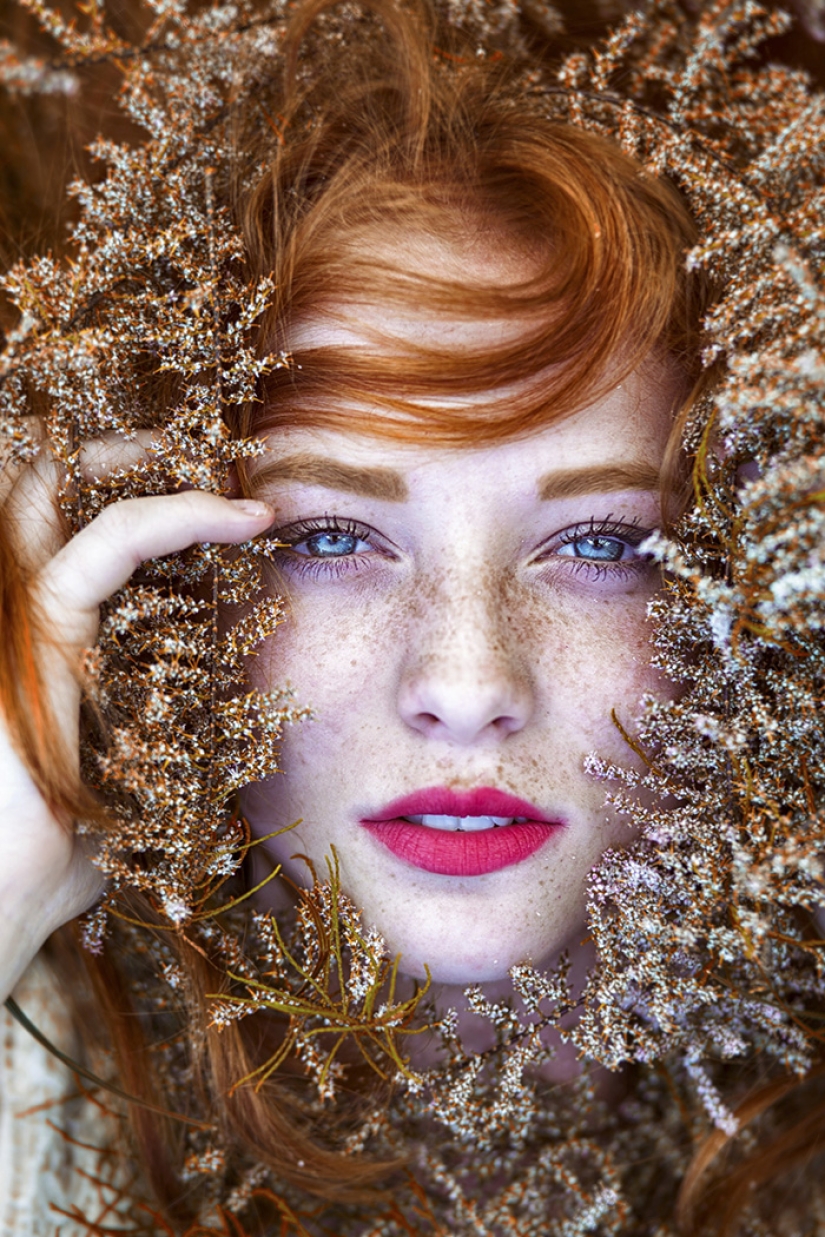Fascinating Photos Of People With Freckles Pictolic