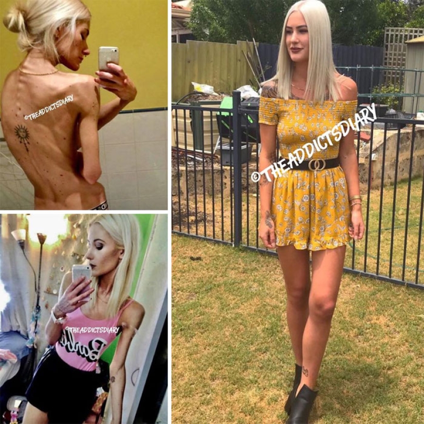 25 fotos de personas antes y después de superar la adicción