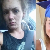 25 fotos de personas antes y después de superar la adicción