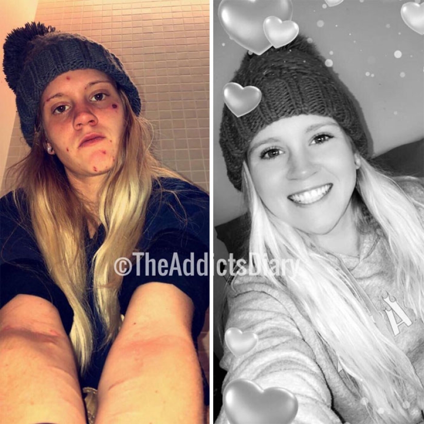 25 fotos de personas antes y después de superar la adicción