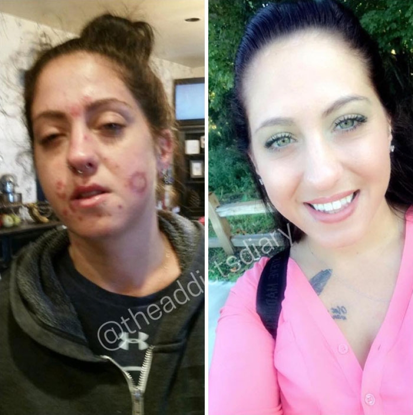 25 photos of people before and after overcoming addiction