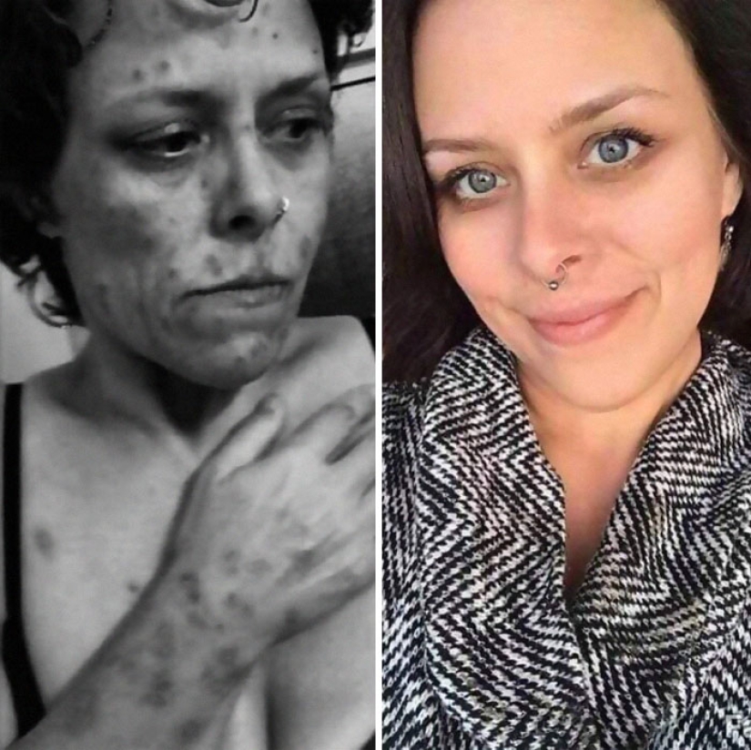 25 photos of people before and after overcoming addiction