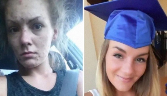 25 photos of people before and after overcoming addiction