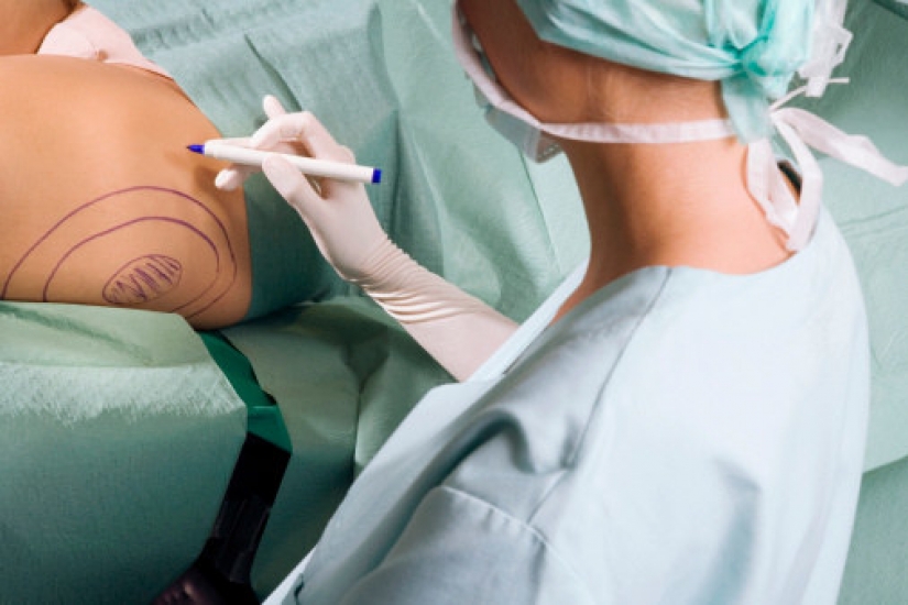 25 revelations of plastic surgeons who destroy stereotypes about their work