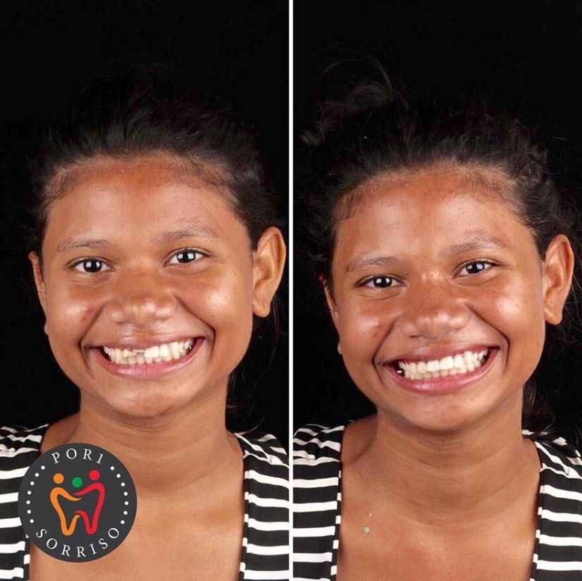30 photos before and after people got their smile back