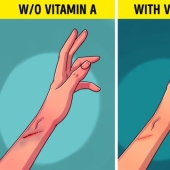6 señales de que su cuerpo necesita más vitamina A
