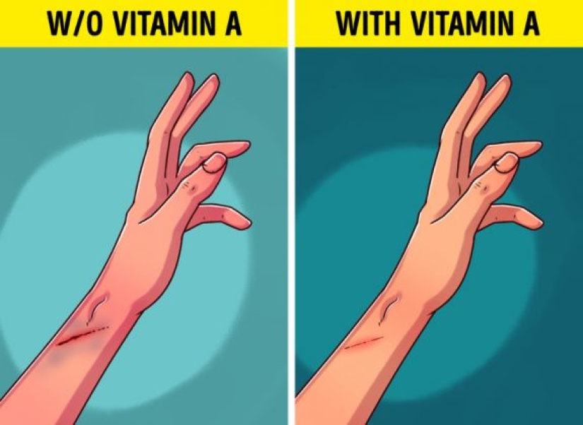 6 señales de que su cuerpo necesita más vitamina A