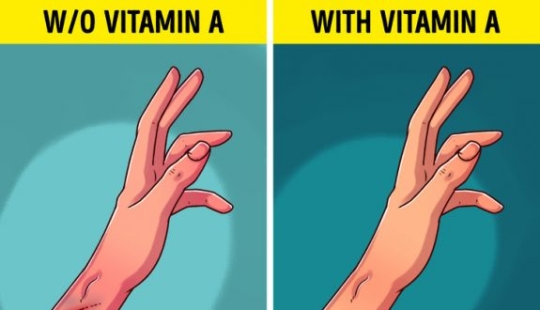 6 señales de que su cuerpo necesita más vitamina A