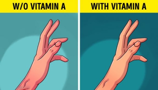 6 Signs Your Body Needs More Vitamin A