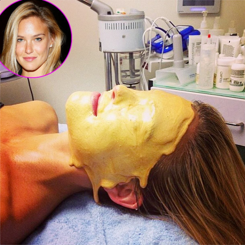 7 horrible cosmetic procedures popular in Hollywood