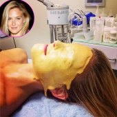 7 horrible cosmetic procedures popular in Hollywood