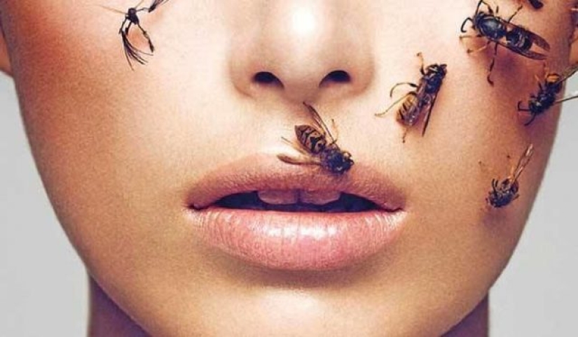 7 horribles procedimientos cosméticos populares en Hollywood