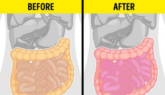 9 condiciones de salud que significan que podría ser peligroso para usted comer tomates