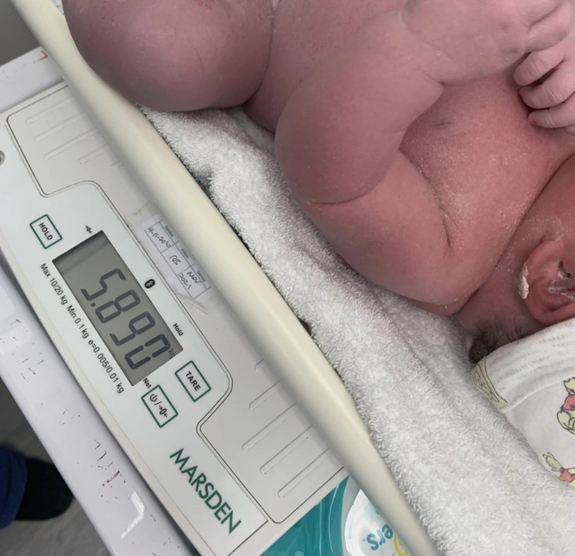 A big miracle: in the UK, a baby hero weighing 6 kg was born