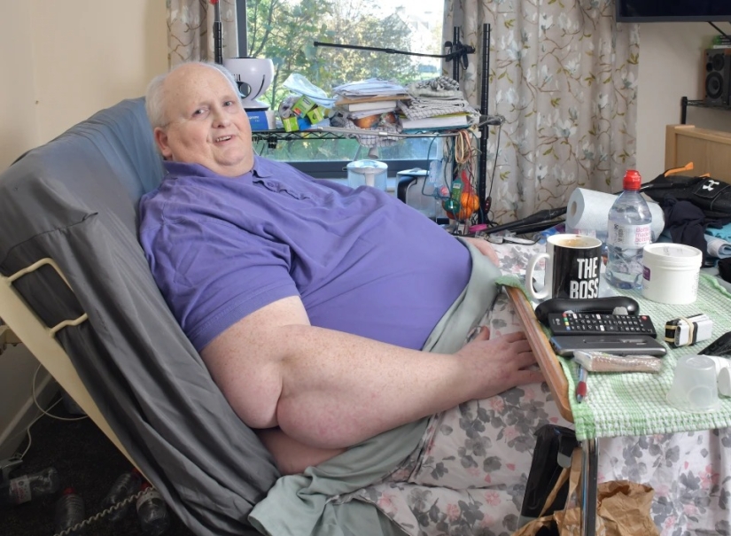 A burden on the heart: the sad story of one of the fattest people in the world