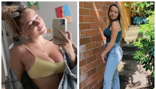 A mountain off her shoulders: an 18-year-old American woman told how her life has improved after breast reduction