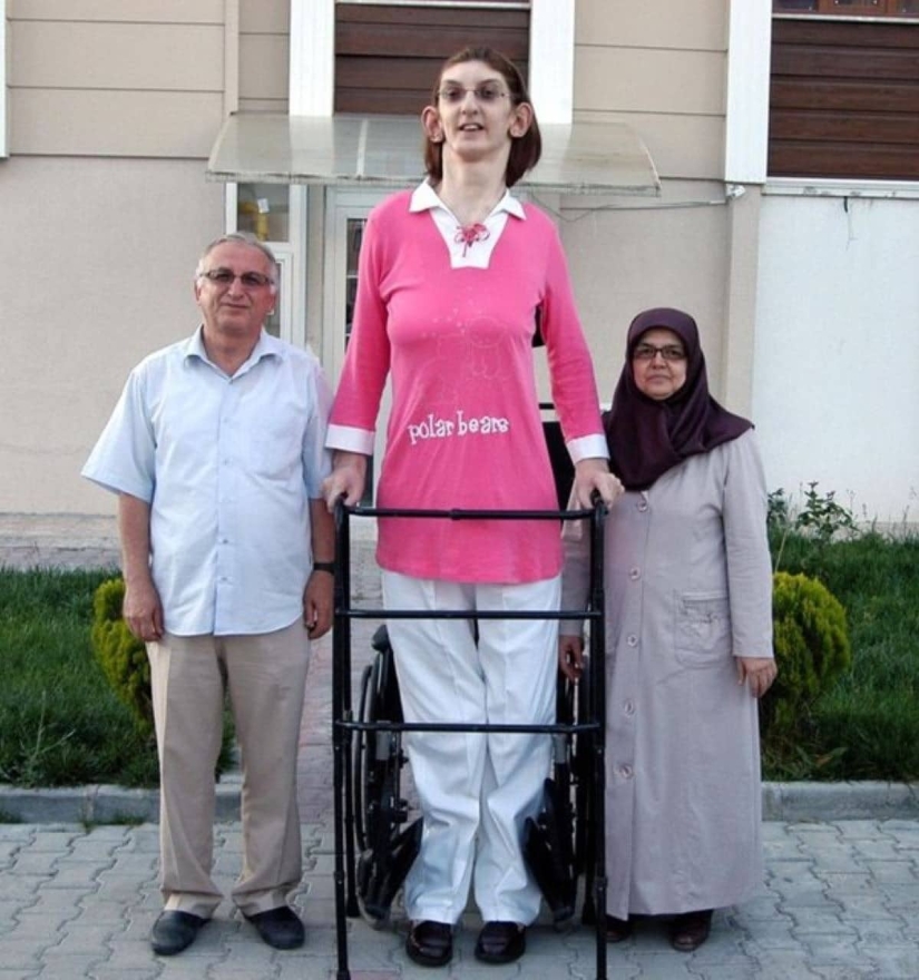 A resident of Turkey has officially become the tallest woman in the world