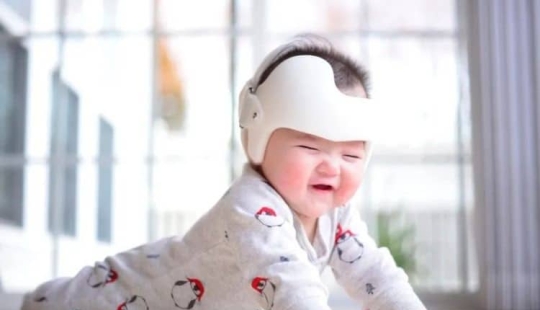 A strange Chinese novelty - a helmet for correcting the shape of the head in newborns