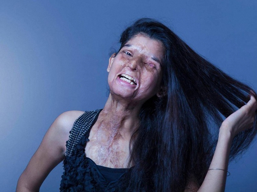 Acid mutilated models from India