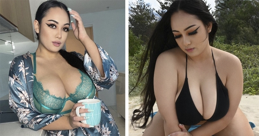 An Australian woman with continuously growing breasts told about her difficult life
