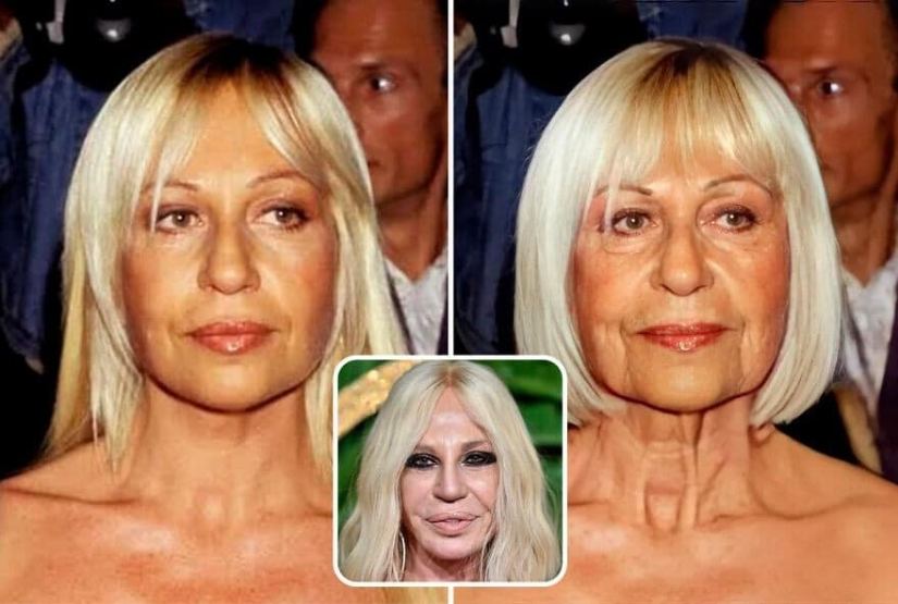 Artificial intelligence has shown how the stars would have aged if not for botox and plastic