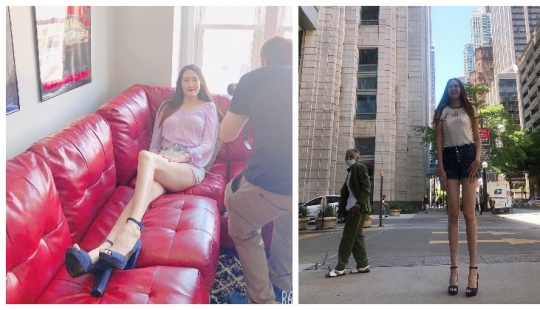 As Renee looks bad, the owner of the longest legs in the world