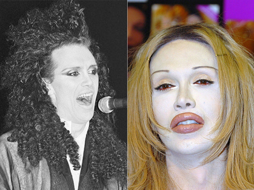 Beauty requires: 8 victims of plastic surgery