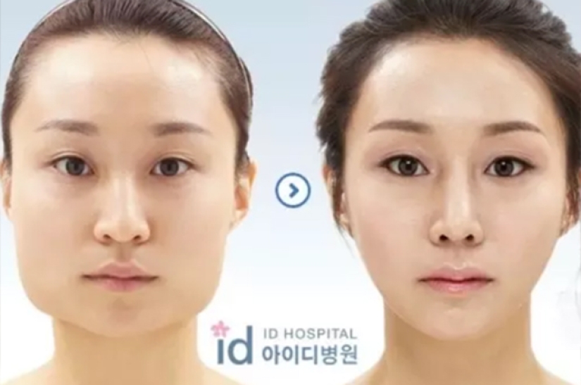 "Cherry lips", jaw reduction, plastic nostrils: what operations are popular in South Korea