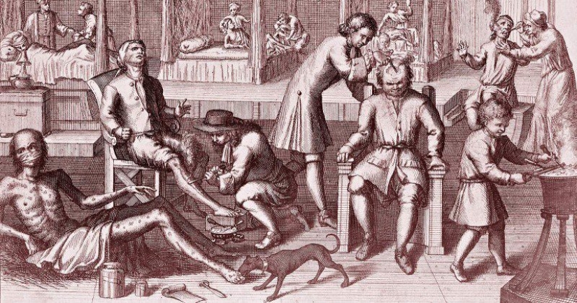 Cómo se trataban las enfermedades venéreas en los viejos tiempos: pesas de plomo, un látigo y ungüentos de mercurio