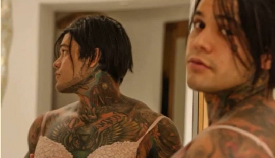 Columbian blogger lost a bet and made themselves silicone breast Columbian blogger lost a bet and made themselves silicone breast