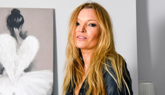 Como dos gotas de agua: la doble de Kate moss dice cómo afectó su vida similitudes con la estrella