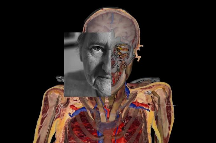 "Congelar y cortar mi cuerpo" : una anciana legada para cortar y digitalizar su cadáver