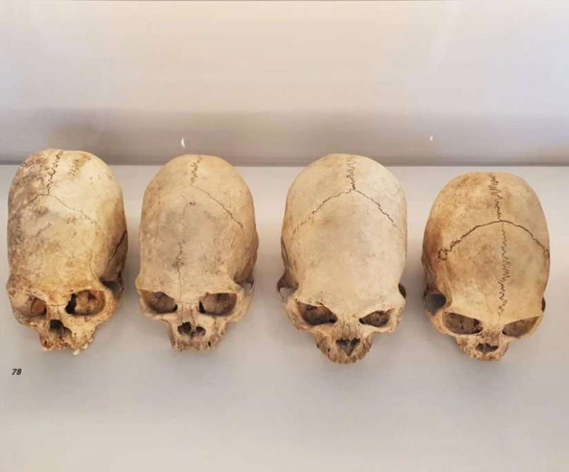 Count of bone? On the black market Instagram appeared human remains