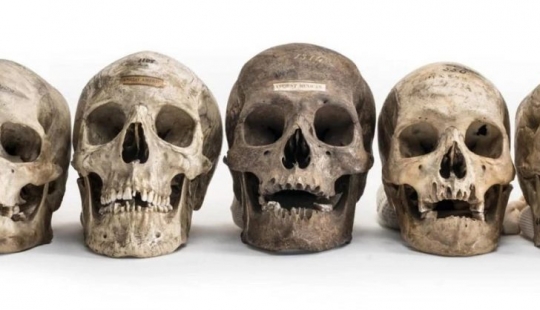 Count of bone? On the black market Instagram appeared human remains