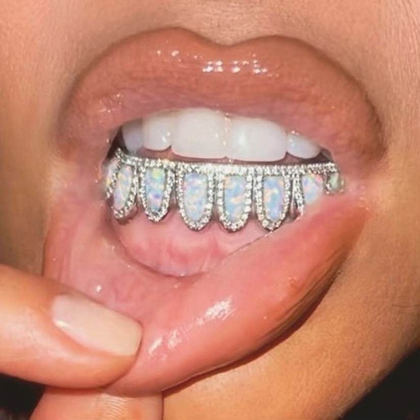 Diamante de dientes: las estrellas se jactan grizli de oro y piedras preciosas