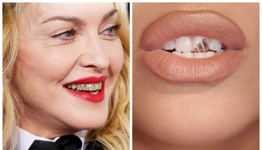 Diamond teeth: stars boast grizli of gold and precious stones
