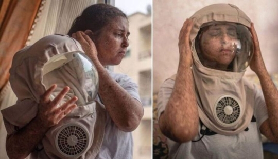 Due to a rare allergy to the sun, a woman from Morocco walks in a spacesuit