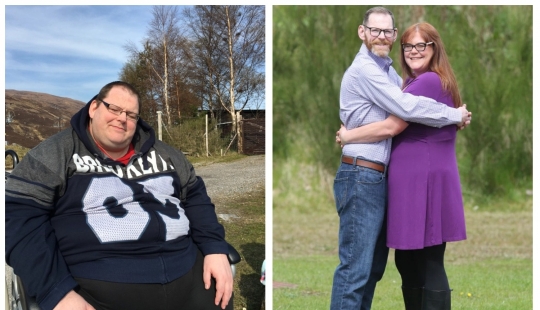 El británico más gordo perdió 270 kg porque tenía miedo de aplastar a su esposa en la cama