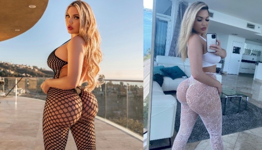 El modelo delgado aumentó las nalgas y luego amargamente lo lamentó El modelo delgado aumentó las nalgas y luego amargamente lo lamentó