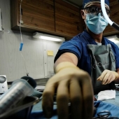 En los EE.UU., los cirujanos extirparon un diente que creció en la nariz de un hombre