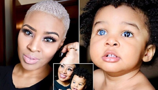 Esta mujer americana y su pequeño hijo conquistaron Internet con sus ojos inusuales