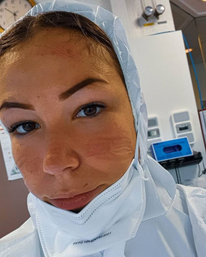 "Estas heridas no desaparecerán, permanecerán dentro de nosotros": fotos de chicas médicas con rastros de máscaras en sus rostros